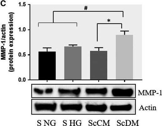 Detection of Human MMP-1 by Western Blot