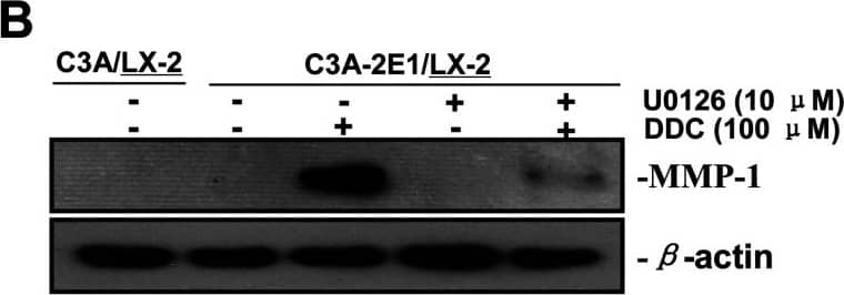 Detection of Human MMP-1 by Western Blot