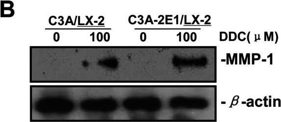 Detection of Human MMP-1 by Western Blot