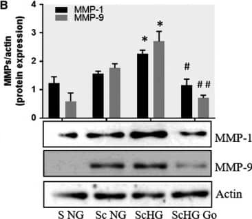 Detection of Human MMP-1 by Western Blot