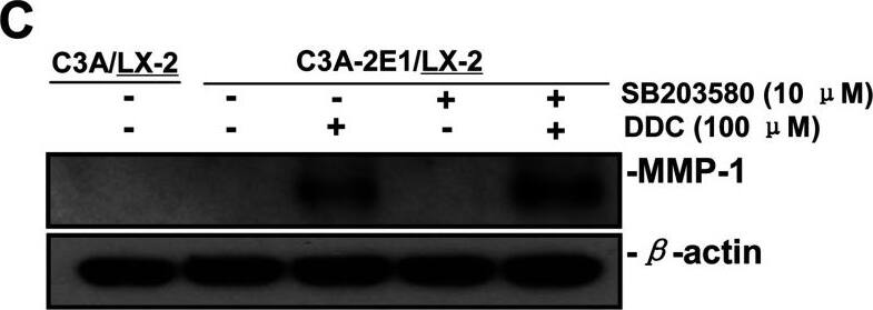 Detection of Human MMP-1 by Western Blot