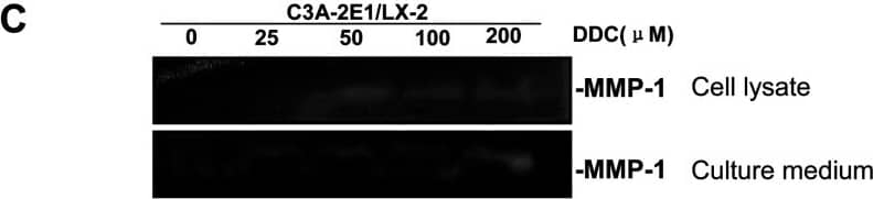Detection of Human MMP-1 by Western Blot