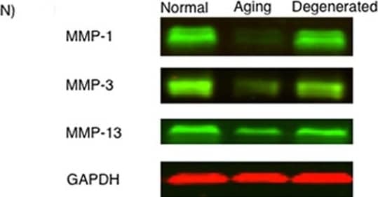 Detection of MMP-1 by Western Blot