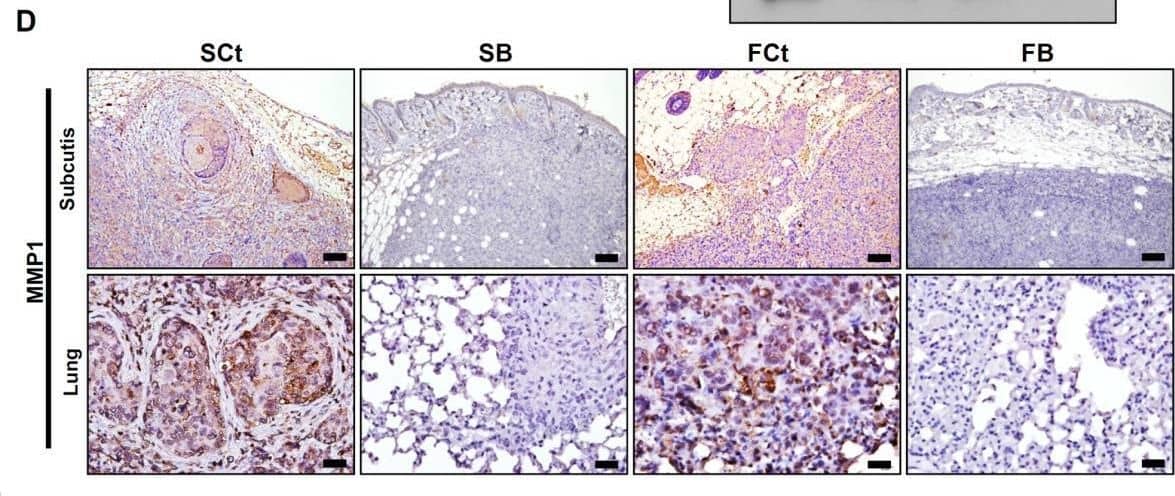Detection of MMP-1 by Immunohistochemistry