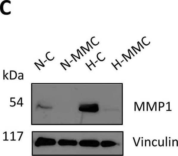 Detection of MMP-1 by Western Blot