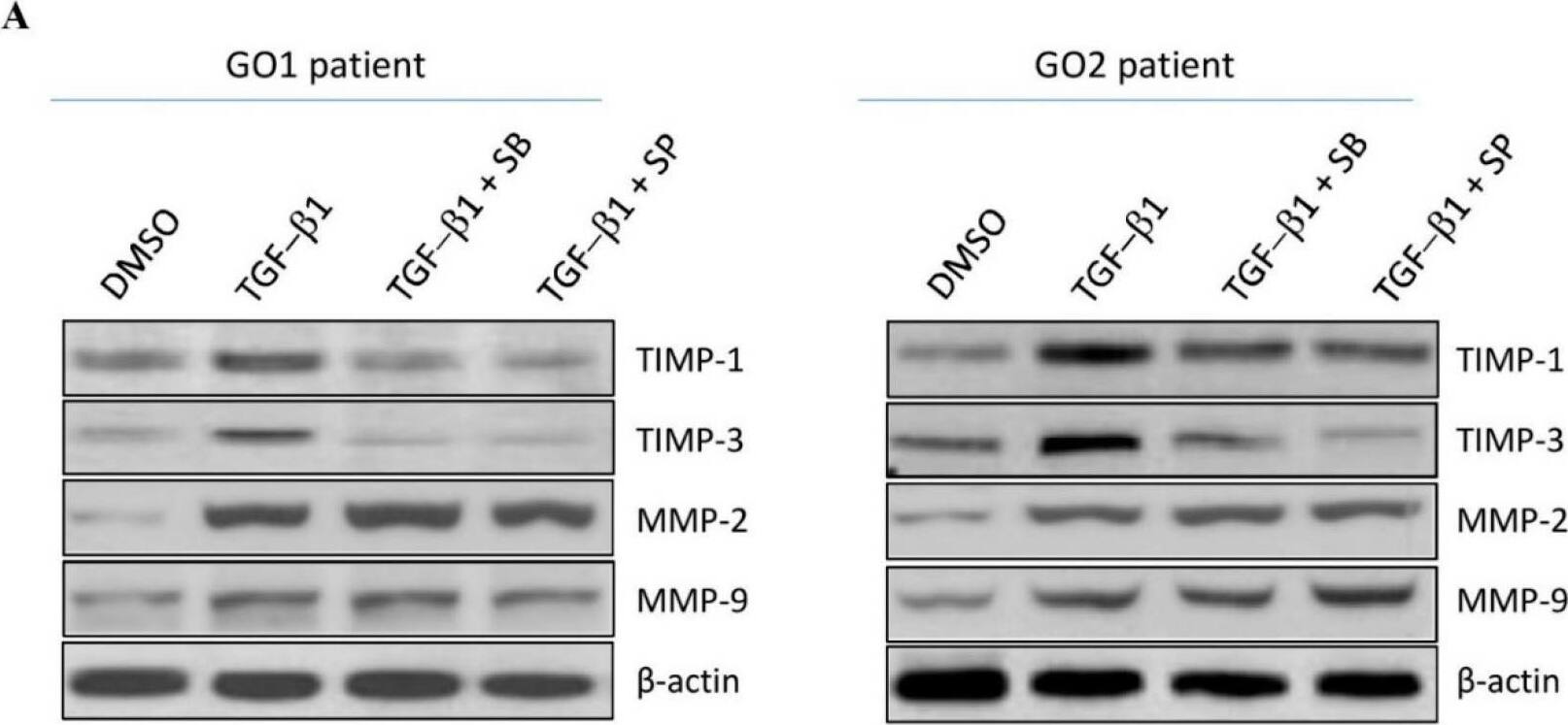 Detection of MMP-2 by Western Blot