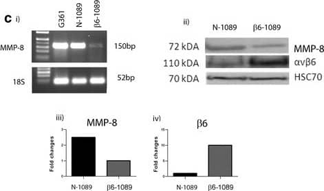 Detection of Human MMP-8 by Western Blot