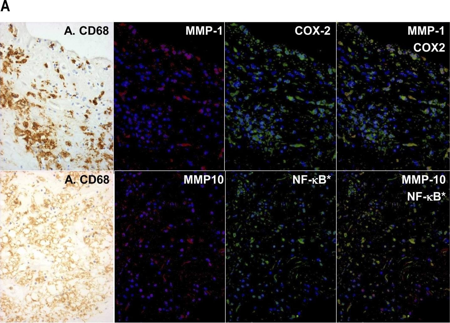 Detection of Human MMP-10 by Immunohistochemistry