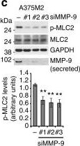 Detection of Human MMP-9 by Knockdown Validated
