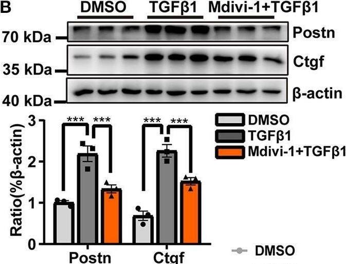 Detection of CTGF/CCN2 by Western Blot