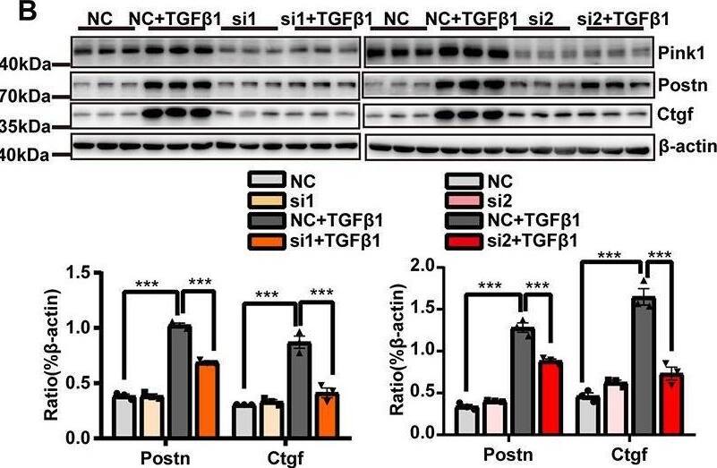 Detection of CTGF/CCN2 by Western Blot