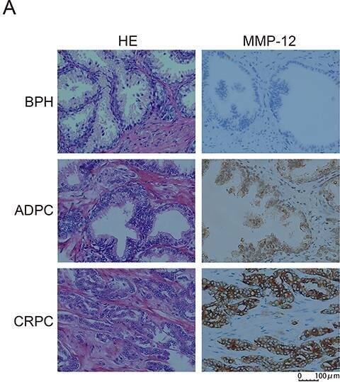 Detection of MMP-12 Catalytic Domain by Immunohistochemistry