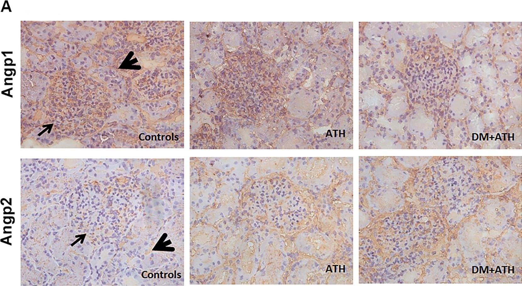 Detection of Porcine Angiopoietin-1 by Immunohistochemistry
