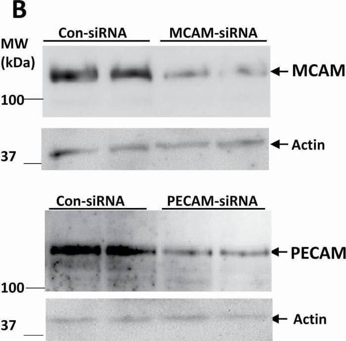 Detection of MCAM/CD146 by Western Blot