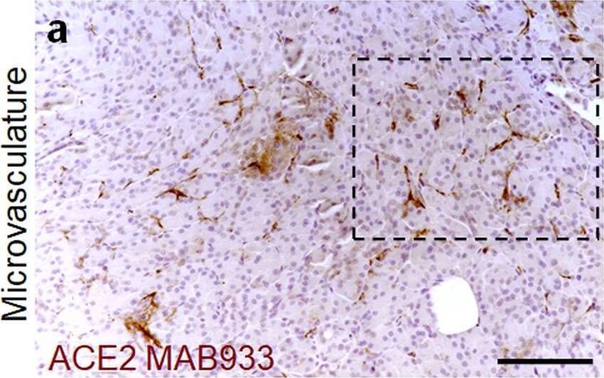 Detection of Human ACE-2 by Immunohistochemistry