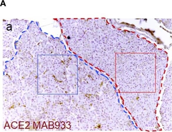 Detection of Human ACE-2 by Immunohistochemistry