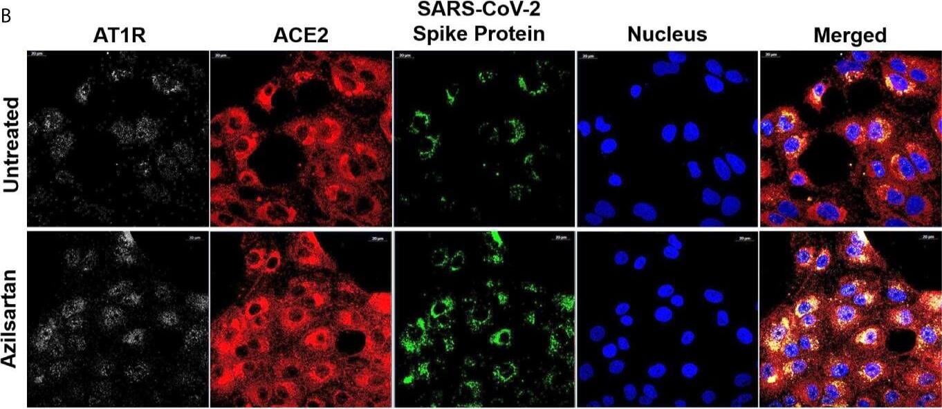 Detection of Chlorocebus sabaeus ACE-2 by Immunocytochemistry/ Immunofluorescence