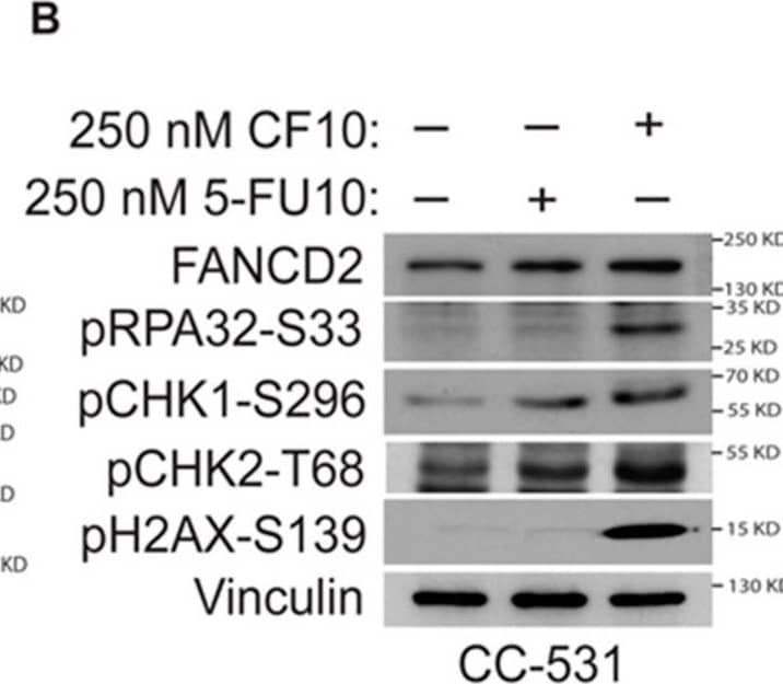 Detection of FANCD2 by Western Blot