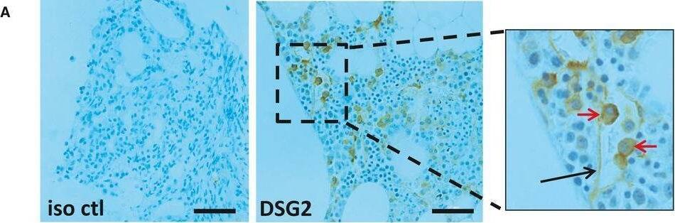 Detection of Desmoglein-2 by Immunohistochemistry