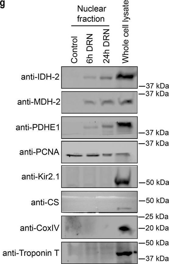 Detection of Kir2.1 by Western Blot
