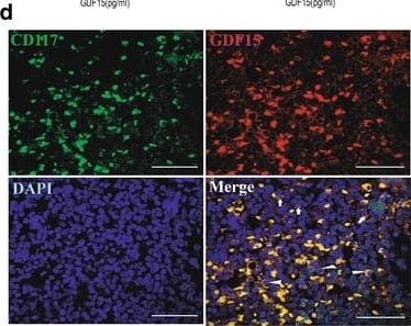 Detection of Human GDF-15 by Immunohistochemistry