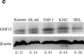 Detection of Human GDF-15 by Western Blot