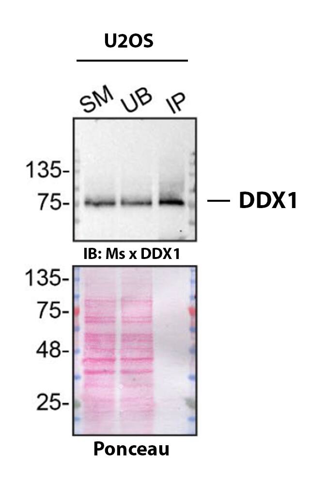 Detection of DDX1 by Immunoprecipitation.
