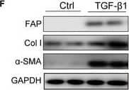 Detection of Fibroblast Activation Protein alpha /FAP by Western Blot
