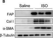 Detection of Fibroblast Activation Protein alpha /FAP by Western Blot