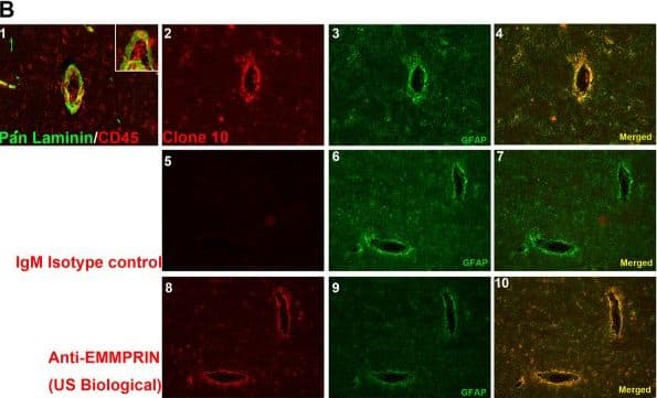 Detection of Human EMMPRIN/CD147 by Immunocytochemistry/Immunofluorescence