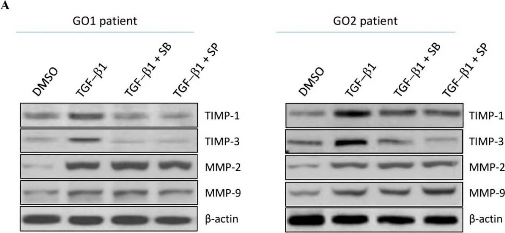 Detection of TIMP-3 by Western Blot
