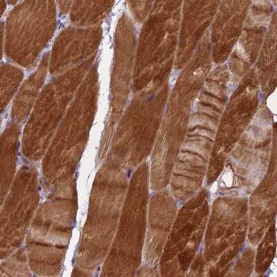 Immunohistochemistry-Paraffin: mediator of cell motility 1 Antibody [NBP1-88269]