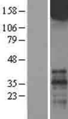 Western Blot: mGluR1 Overexpression Lysate [NBL1-11346]