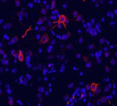 Immunohistochemistry-Frozen: mGluR1 Antibody - BSA Free [NB110-39033]