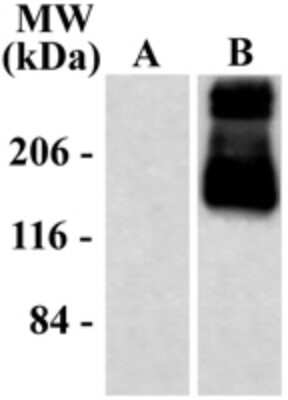 Western Blot: mGluR1 Antibody [NB300-123]