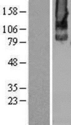 Western Blot: mGluR2 Overexpression Lysate [NBL1-11347]