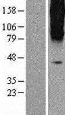 Western Blot: mGluR3 Overexpression Lysate [NBL1-11348]