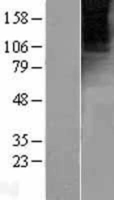 Western Blot: mGluR4 Overexpression Lysate [NBL1-11349]