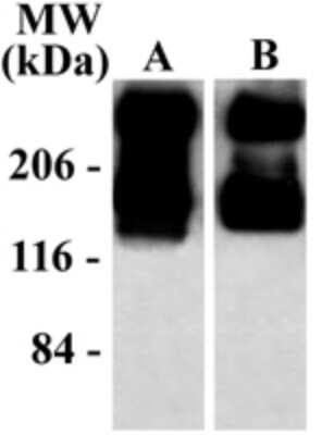 Western Blot: mGluR5/1 Antibody [NB300-126]