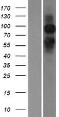 Western Blot: mGluR6 Overexpression Lysate [NBP2-10713]