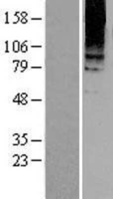 Western Blot: mGluR8 Overexpression Lysate [NBL1-11352]