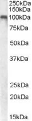 Western Blot: mGluR7 Antibody [NBP1-26397]