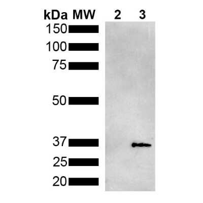 Western Blot: metallothionein Antibody (2B5) [NBP3-18262]