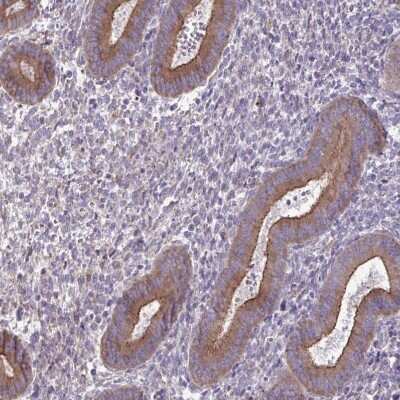 Immunohistochemistry-Paraffin: methyltransferase like 9 Antibody [NBP2-31564]