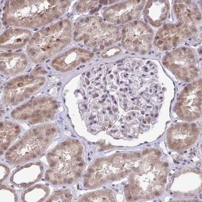 Immunohistochemistry-Paraffin: methyltransferase like 9 Antibody [NBP2-31564]