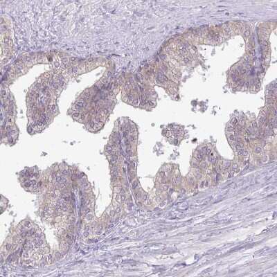 Immunohistochemistry-Paraffin: methyltransferase like 9 Antibody [NBP2-31564]