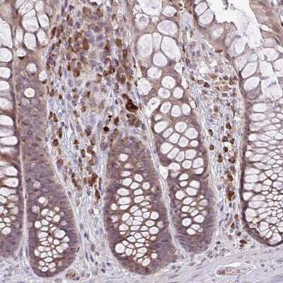Immunohistochemistry-Paraffin: methyltransferase like 9 Antibody [NBP2-31564]