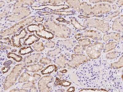 Immunohistochemistry-Paraffin: methyltransferase like 9 Antibody [NBP2-98039]