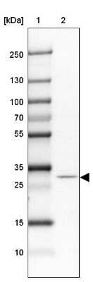 Western Blot: methyltransferase like 9 Antibody [NBP2-31564]