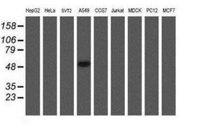 Western Blot: midA Antibody (OTI4A5)Azide and BSA Free [NBP2-72681]